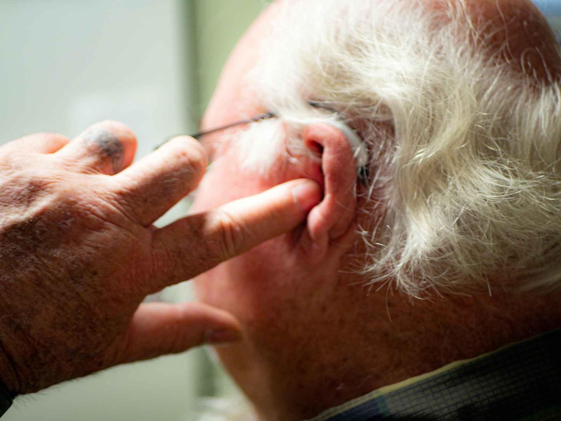 Understanding Unilateral Hearing Loss: Causes and Impacts
